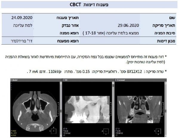 פענוח CBCT - מה השתנה?