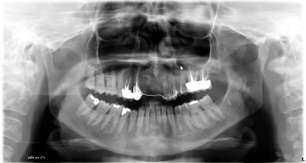 בדיקות שיניים וסוגי צילומים שונים